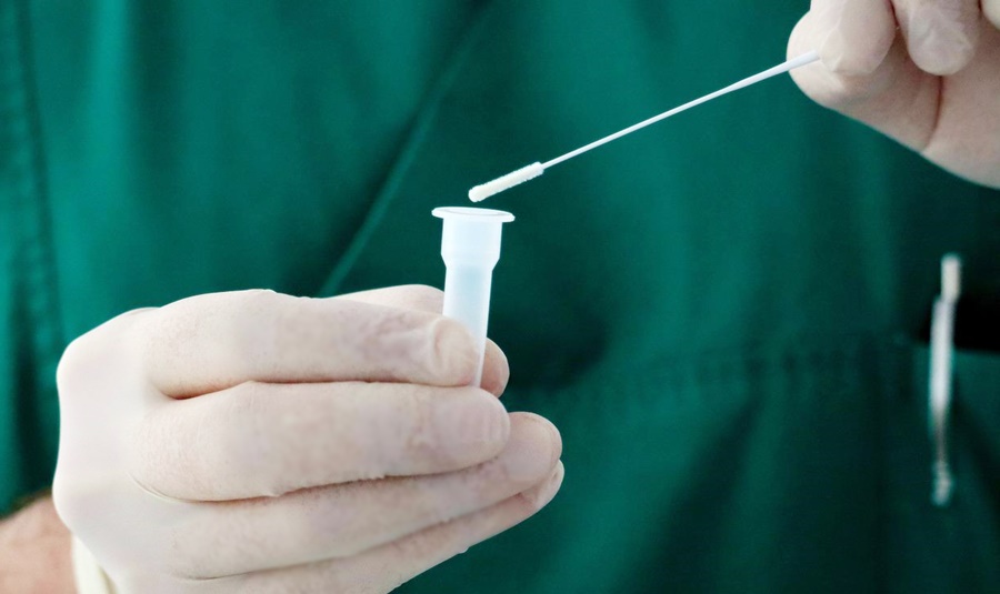 Ministerul Sănătății: Pacienții nu trebuie să plătească testul anti –Covid 19 la internarea într-o unitate&nbsp;sanitară